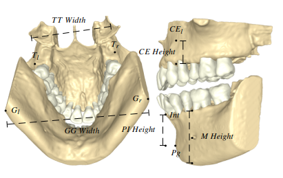 Open-Full-Jaw: An open-access dataset and pipeline for finite element models of human jaw