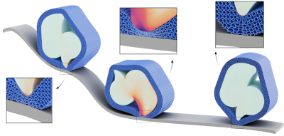 Optimized shock-protecting microstructures